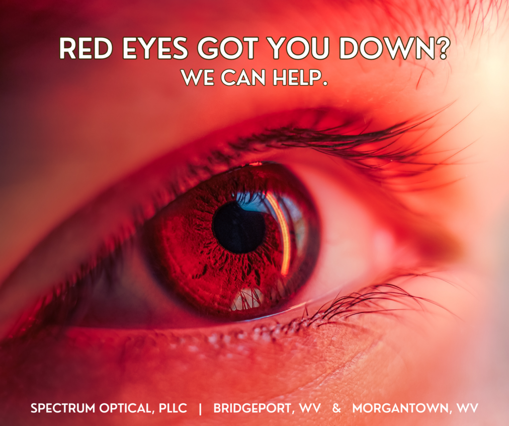 A close-up photo of an eye is shown as a red light shines on the subject's face. The text reads, "Red eyes got you down? We can help."